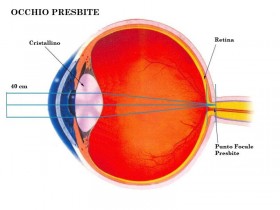 Occhio presbite - OUTLOOK - Outlet dell'Occhiale